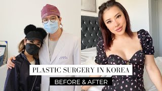 Nose Job Result & Breast Augmentation In South Korea | Plastic Surgery South Korea