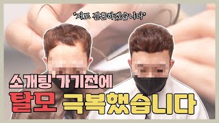 남자는 머리빨이라길래 소개팅 전에 탈모 극복하고 갔네요｜헤어증모술