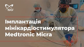 Імплантація мінікардіостимулятора Medtronic Micra