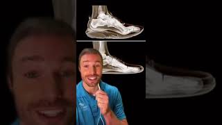 BAD Shoe Feature NIKE & ADIDAS#mensfashion #menstyle #motivation #mentalhealth #muscle #shoes