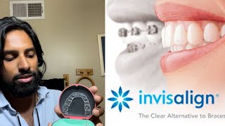 MY FULL INVISALIGN EXPERIENCE!