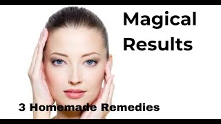 homemade face remedies for pimples|gharelo totkay for skin in urdu