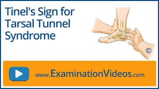 Tinel's Sign  for Tarsal Tunnel Syndrome