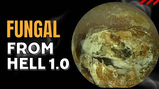 FUNGAL FROM HELL 1.0