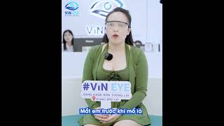 Xóa cận tháo kính có sướng không ? #vineye #mocan #canthi #loanthi #ducthuytinhthe