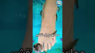 هل سمعت عن الأسماك التي تعالج البشرة؟ 🐟 حقائق | غريب | مثير