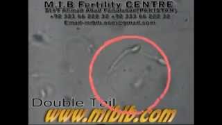 double tail sperm video