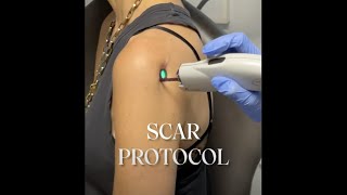 PFRANKMD Scar Protocol