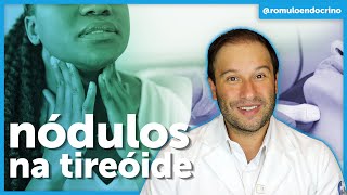 NÓDULO de TIREOIDE - Devo me preocupar?