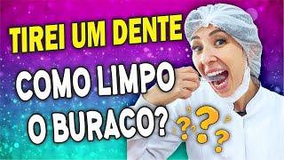 TIREI UM DENTE: COMO LIMPAR O BURACO QUE FICOU? DRA. Jaque Akemi - LONDRINA-PR