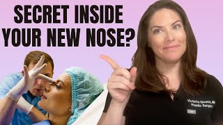 The Hidden Truth About Nose Job Recovery: Splints Exposed