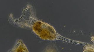 Tentacles of a Mother Rotifer