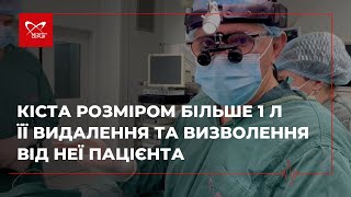 Кіста розміром більше 1 л | Її видалення та визволення від неї пацієнта