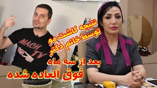 کاشت مو در ایران بعد از سه ماه چه شکلی شدم😱جواب تمام سوالهای شما در مورد کاشت مو اینجاست 🤔