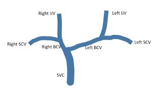 Venous Anatomy of the Upper Thorax and Central Venous Catheter