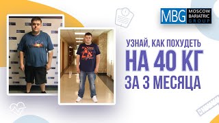 Минус 40 кг за 3 месяца | Отзыв после резекции желудка