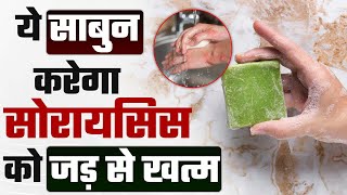 Can psoriasis be cured permanently | सोरायसिस रोगियों के लिए सबसे अच्छा साबुन कौन सा है?