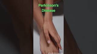 Parkinson's Disease│ Selected medical terminology │ #medicalterminology #parkinson #short