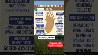 О чем говорят мозоли на стопах