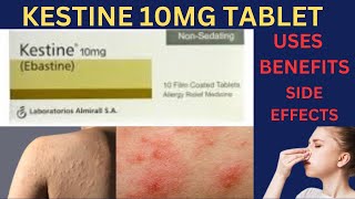 kestine Tablet 10mg ! kestine tablet uses in english ! kestine ebastine 10mg ! kestine non sedative