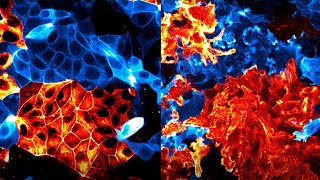 Apical vs Basal actin