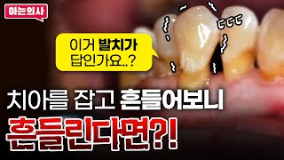 치아 흔들림 해결방법은? 무조건 발치해야 할까?