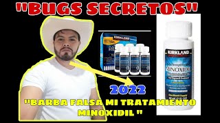 🧔😮Barba Minoxidil 2022  como tener Barba últimos resultados de mi tratamiento