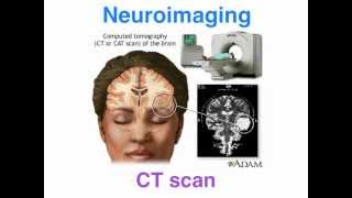 CT vs MRI - structural neuroimaging