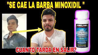 🧔Cuanto se tarda en tener Barba Minoxidil sin que se caiga?Mis resultados Minoxidil