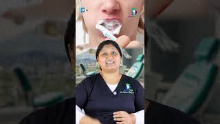 Which Toothpaste to Use? - எந்த பேஸ்ட் பயன்படுத்தலாம்? | Dr.Aparna | Denta Kings