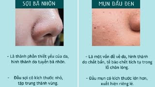 Seri Nặn Mụn-Part 16 Bã nhờn vùng mũi bao lâu lại xuất hiện