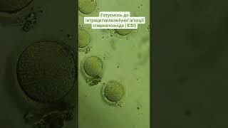 We are preparing for intracytoplasmic sperm injection. Готуємось до   ін'єкції сперматозоїда. #icsi