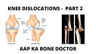 TRAUMATIC KNEE DISLOCATION - PART 2- EPISODE 2