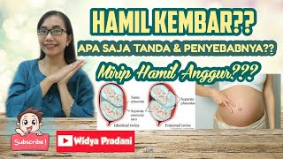 KEHAMILAN KEMBAR (GEMELLI) | TANDA-GEJALA, PENYEBAB, PROSES TERJADINYA??