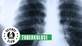 Tödliche Krankheit: Der Mechanismus der Tuberkulose (Christian Herzmann – Science Slam)