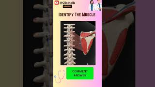 Identify the Muscle of upper limb  #anatomy #neetpgmcq #upperlimbanatomy