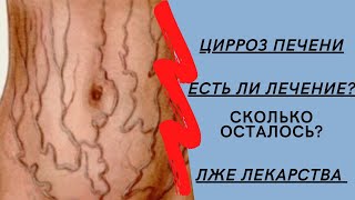 Цирроз печени: чем лечить? Причины? Сколько живут ► Как распознать цирроз печени на ранних стадиях?