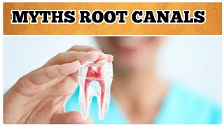 Myths About Root Canals