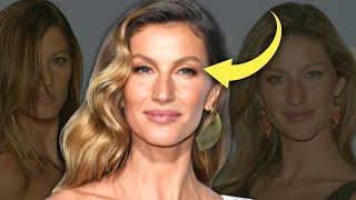 Gisele Bundchen's Plastic Surgery Mistake - PLUS ANALYSIS!