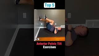 Top 5 Anterior Pelvic Tilt Exercises