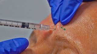 Botox Procedure At A local Med Spa In San Antonio, Texas