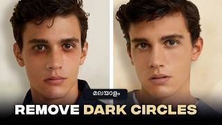 How to reduce dark circles | Causes and remedies for dark circles | Men's Fashion Malayalam