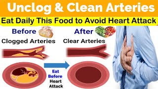 These are the Best Foods To Clear Arteries | Unclog Arteries