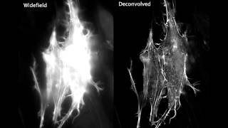 Actin dynamics viewed with deconvolution microscopy