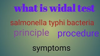 widal test procedure / qualitative and quantitative