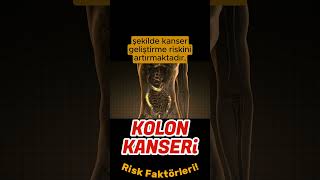 Kolon kanseri risk faktörleri nelerdir? #shortsvideo