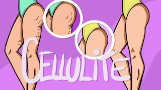 Come ELIMINARE la cellulite 🍑  | Nuovo studio scientifico (2024🔥)