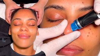 ASMR: Массаж HydraFacial на основе BRITENOL, отмеченный наградами в спа-салоне