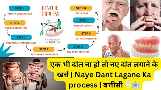 एक भी दांत ना हो तो नए दांत लगाने के खर्च | Naye Dant Lagane Ka process | बत्तीसी का खर्चा