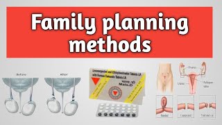 FAMILY PLANNING METHODS